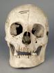 human skull with mandible